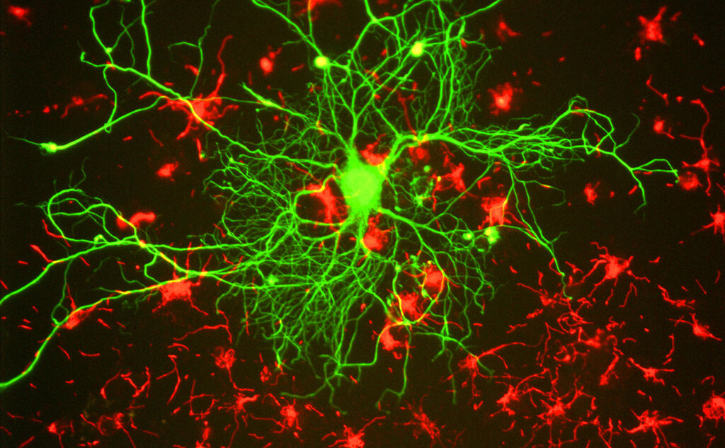 Человеческий нейрон под увеличением. Фото: Wikipedia (CC)
