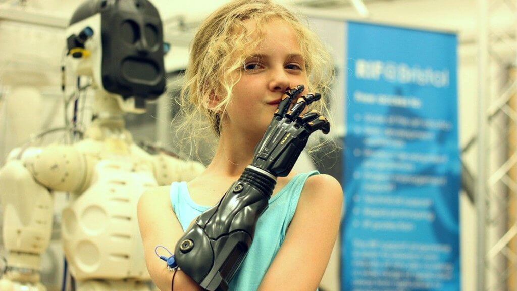 Десятилетняя Тилли получила бионический протез руки от Open Bionics. Когда Тилли было 15 месяцев у нее диагностировали менингит. Результатом болезни стала ампутация обеих рук. Спустя несколько лет, компания Open Bionics, специализирующаяся на разработке бионических протезов с использованием 3d печати, искала волонтеров для тестирования своих новых протезов. Тилли приняла участие в программе и получила новую руку.