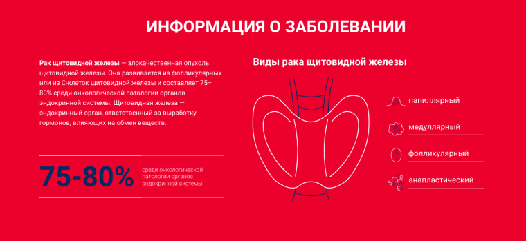 Информация о раке щитовидной железы. Инфографика с сайта «Онконавигатор».